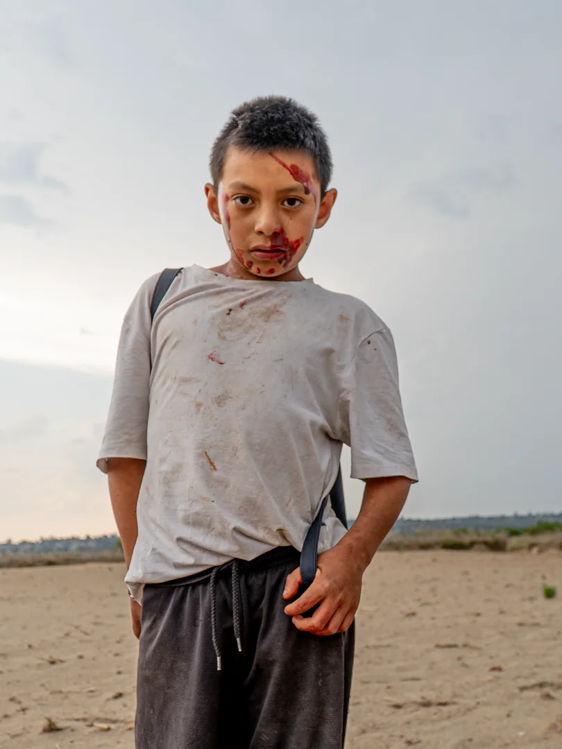 Niño de pie en un terreno baldío con el rostro manchado.